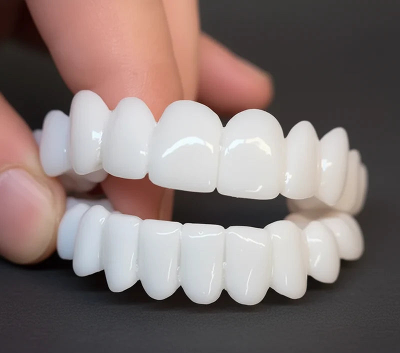 Snap on Smile Veneers (Upper & Lower)